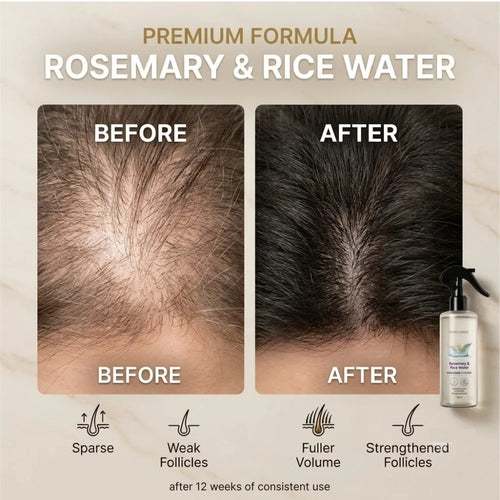 Rosemary Rice Water Hair Growth Spray